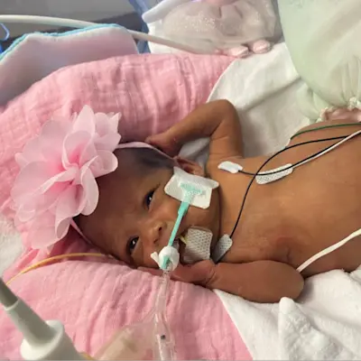 Sophia as a newborn at Children's Nebraska.