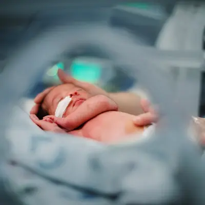 Premature baby at Children's Nebraska.