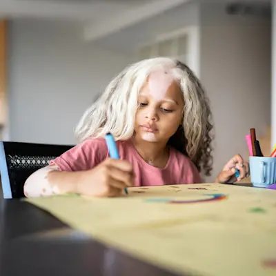 Girl with vitiligo coloring on paper.