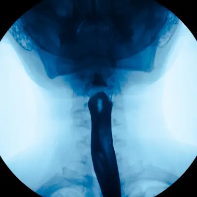 Esophogram scan image