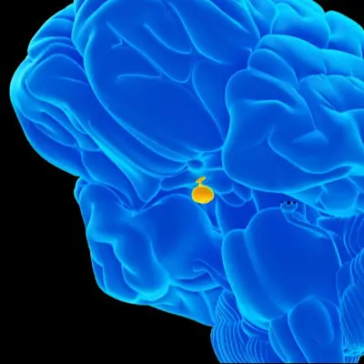 Secondary Adrenal Insufficiency graphic