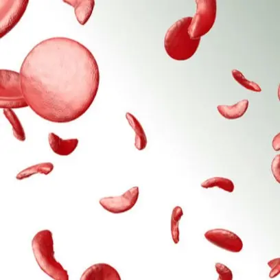 Sickle Cell Disease graphic.