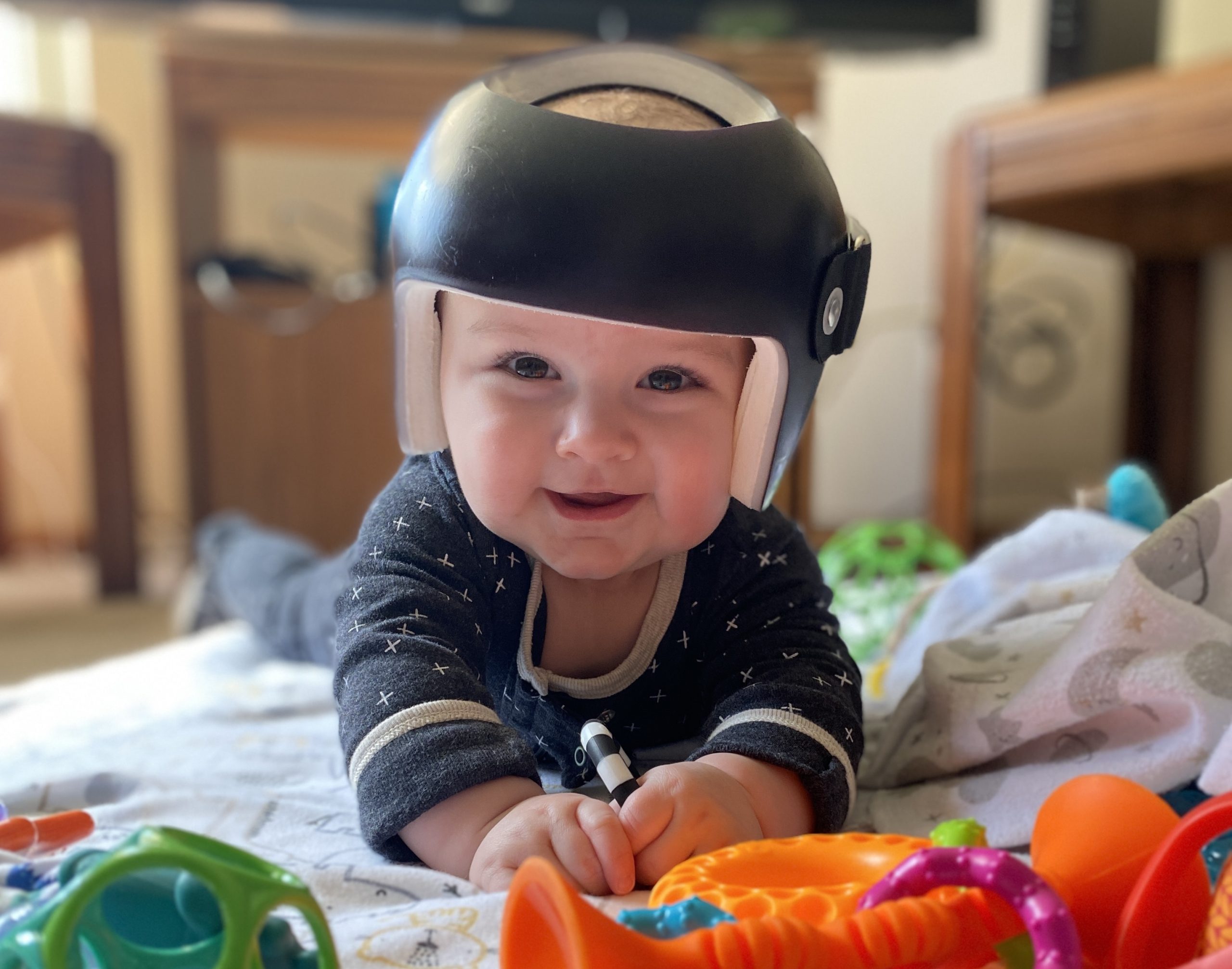 Eli’s Story: Helmet therapy to treat plagiocephaly made a world of difference